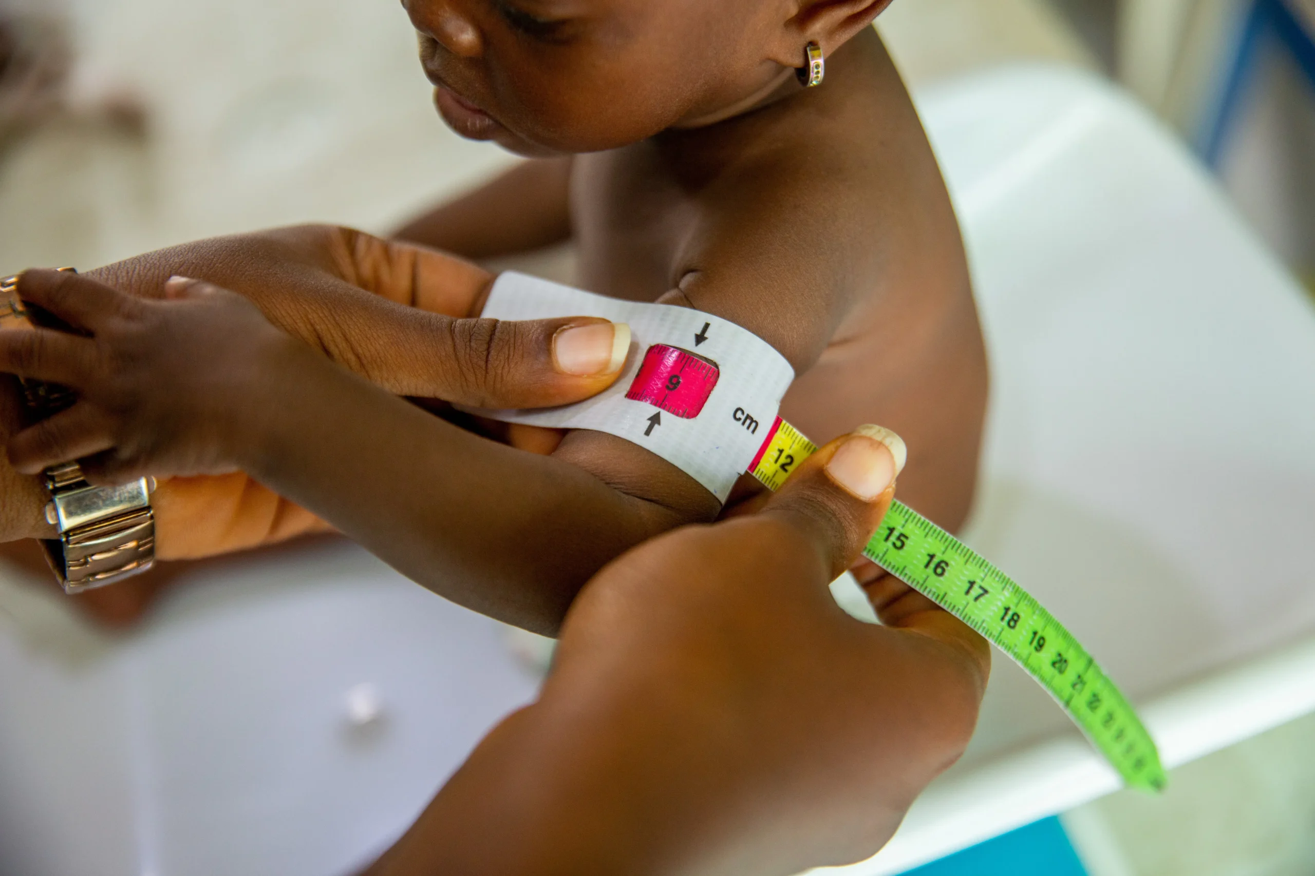 A healthcare provider measures the upper arm circumference of a child, relevant to social impact assessments often part of ESG risk consulting and advisory services.